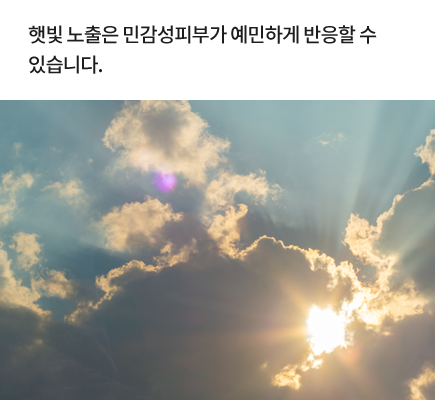 햇빛 노출은 민감성피부가 예민하게 반응할 수 있습니다.