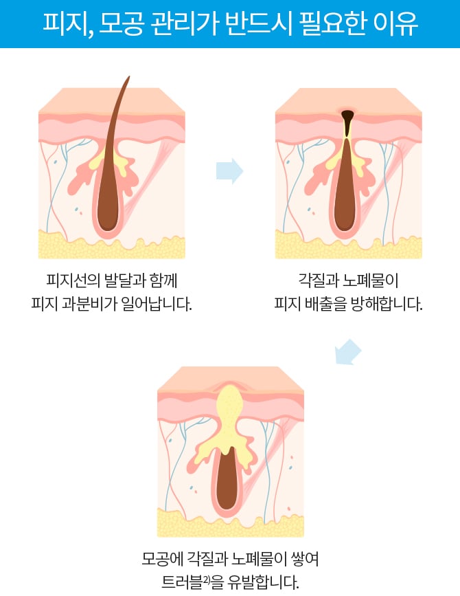 피지,모공관리가 반드시 필요한 이유 1.피지선의 발달과 함께 피지 과분비가 일어납니다. 2.각질과 노폐물이 피지 배출을 방해합니다. 3. 모공에 각질과 노폐물이 쌓여 트러블을 유발합니다.